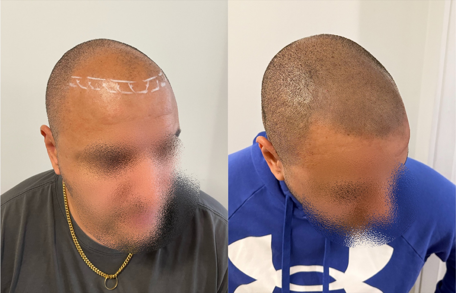 Shaved look SMP portfolio 18